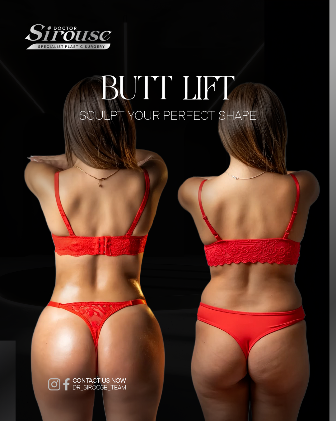 Butt lift result, rear view